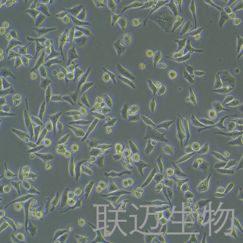 Hela细胞（人宫颈癌细胞STR鉴定正确）LM8C0101