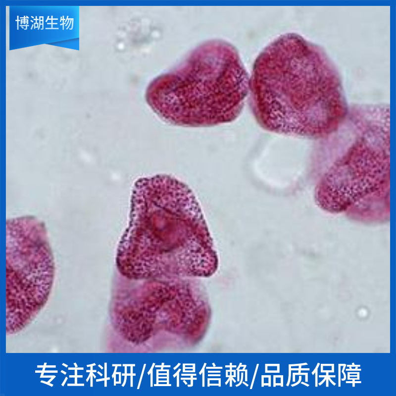 NB16人神经母细胞瘤细胞