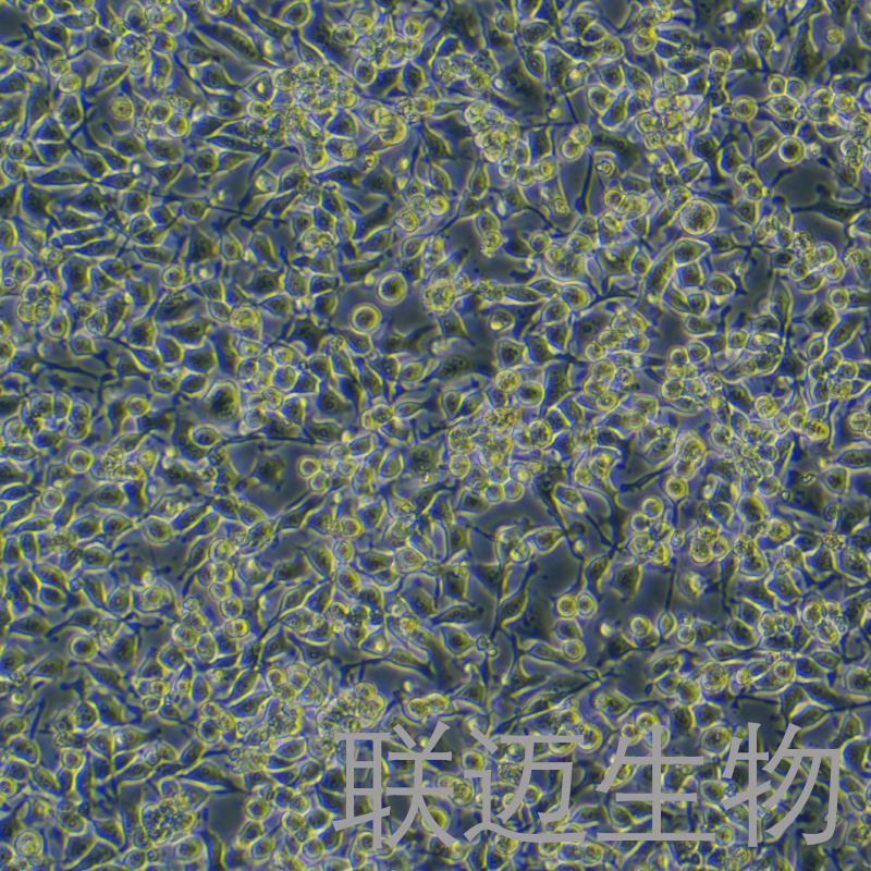 HO-8910细胞（卵巢癌细胞）LM8C0113