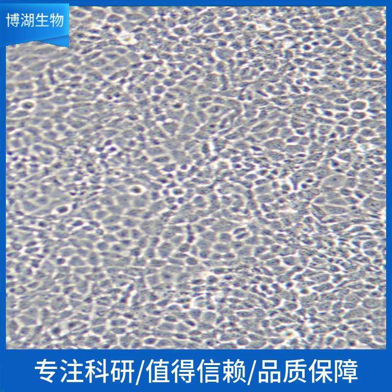 KYSE-270人食管鳞状癌细胞