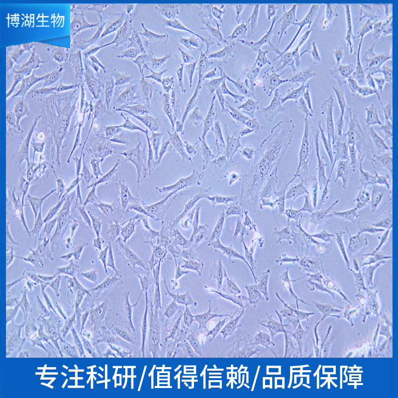 Jiyoye人淋巴癌细胞