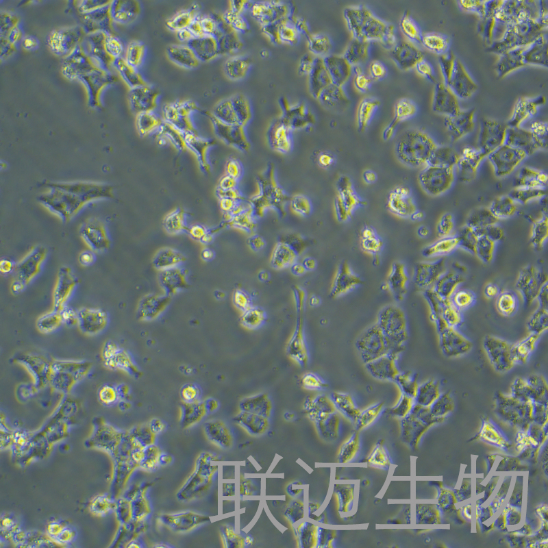 RH-35细胞（大鼠肝癌细胞种属鉴定正确）LM8C0195