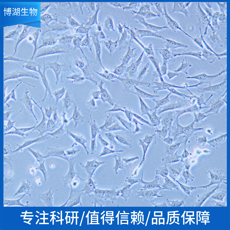 HOS人骨肉瘤细胞