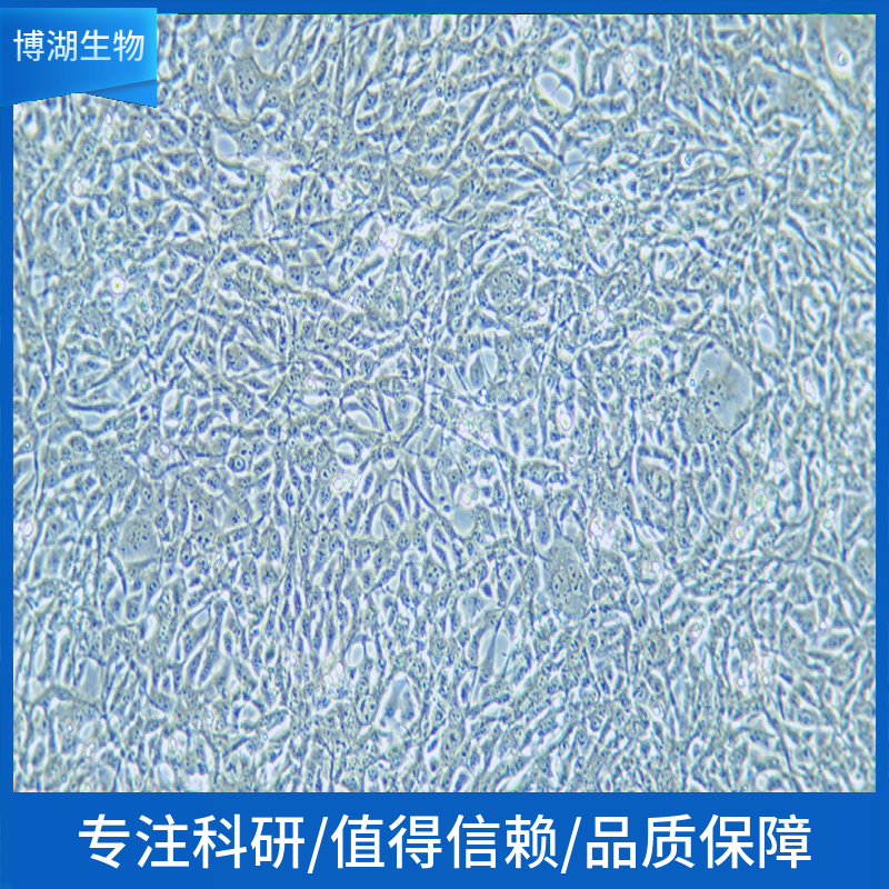 RKO人结肠腺癌细胞