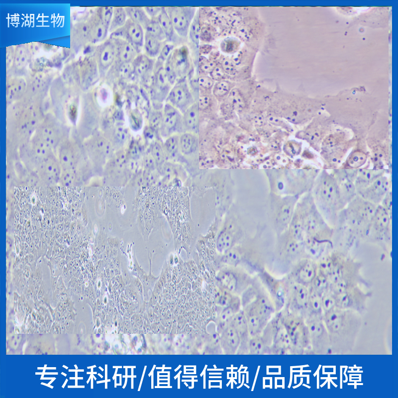 AGS人胃腺癌细胞