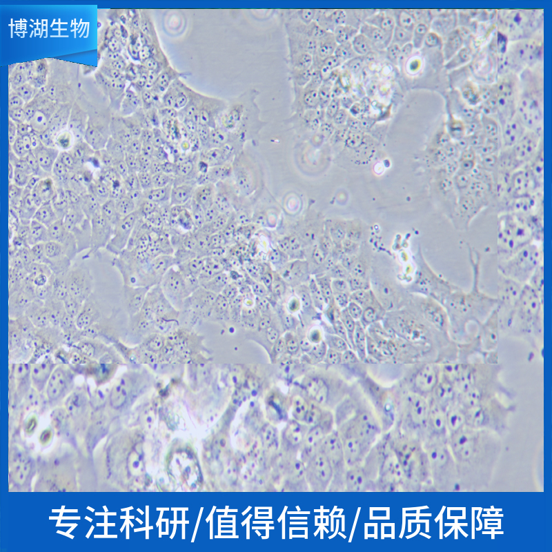 NCI-H727 [H727]人肺支气管良性肿瘤细胞