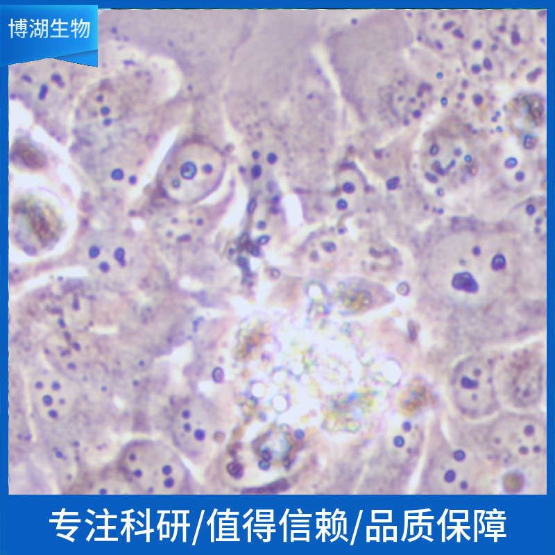 T98G人脑部多形性成釉细胞瘤细胞