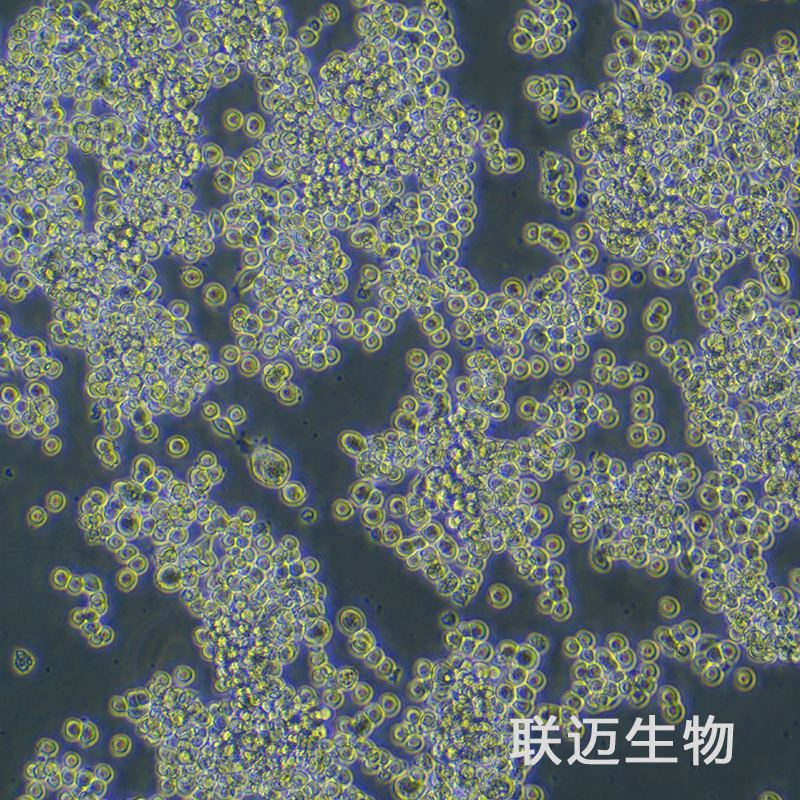 MKN-45细胞（胃癌细胞STR鉴定正确）LM8C0292
