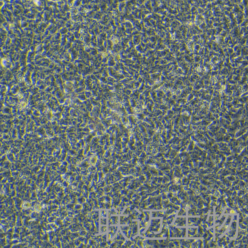 PA-1细胞（卵巢畸胎瘤细胞）LM8C0411