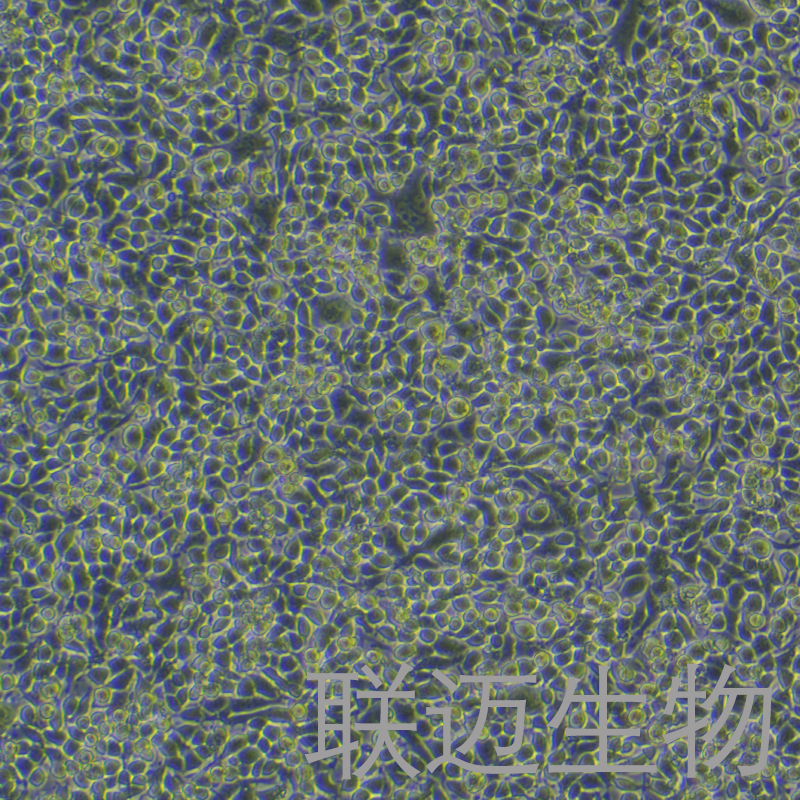 MLO-Y4[MLOY4]细胞（小鼠骨样细胞）LM8C0567