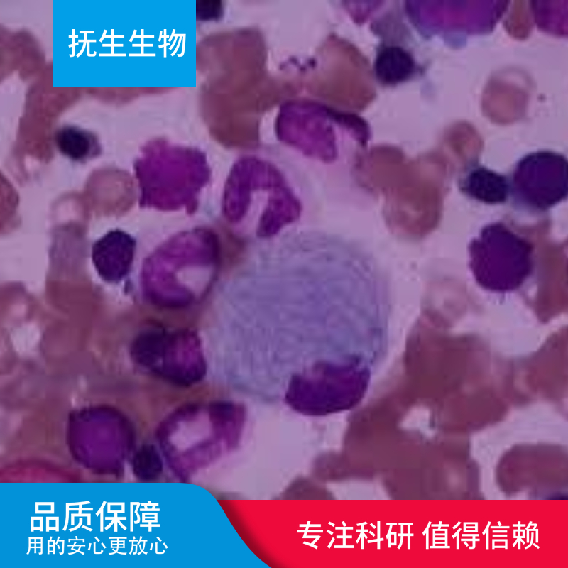 人小细胞肺癌 ；DMS-153 (STR)