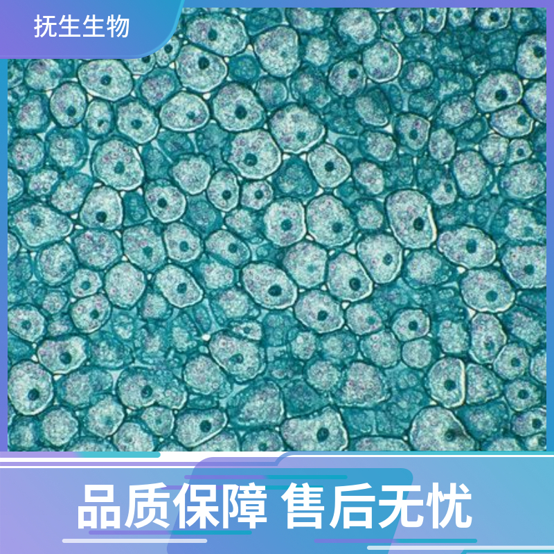LS180人结肠癌细胞