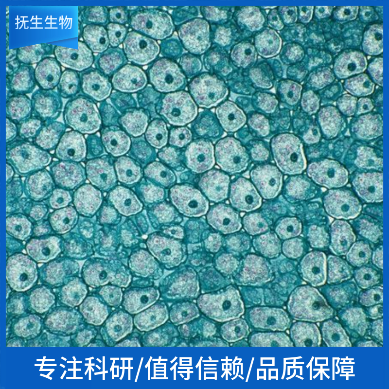 Hep 3B2.1-7 [Hep 3B, Hep-3B, Hep3B]人肝癌细胞