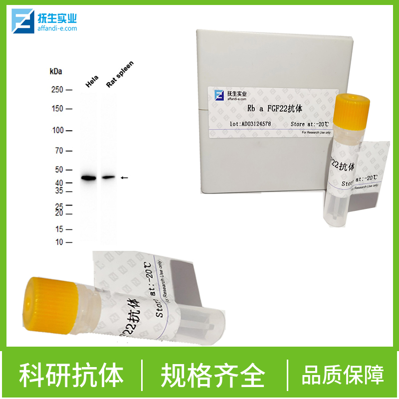 G蛋白偶联受体147抗体
