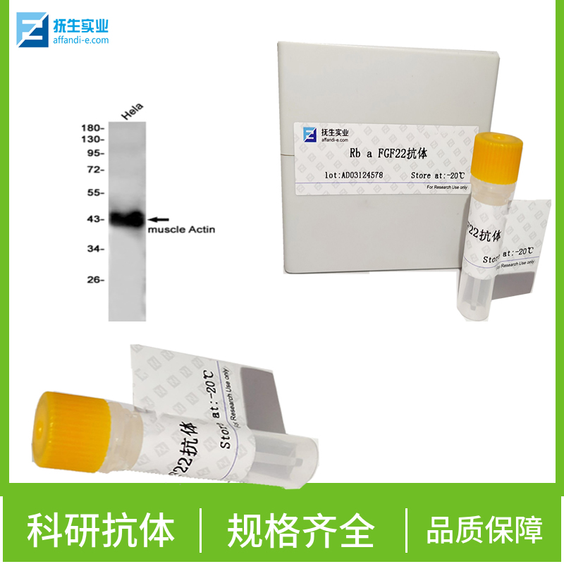 G蛋白偶联受体84抗体