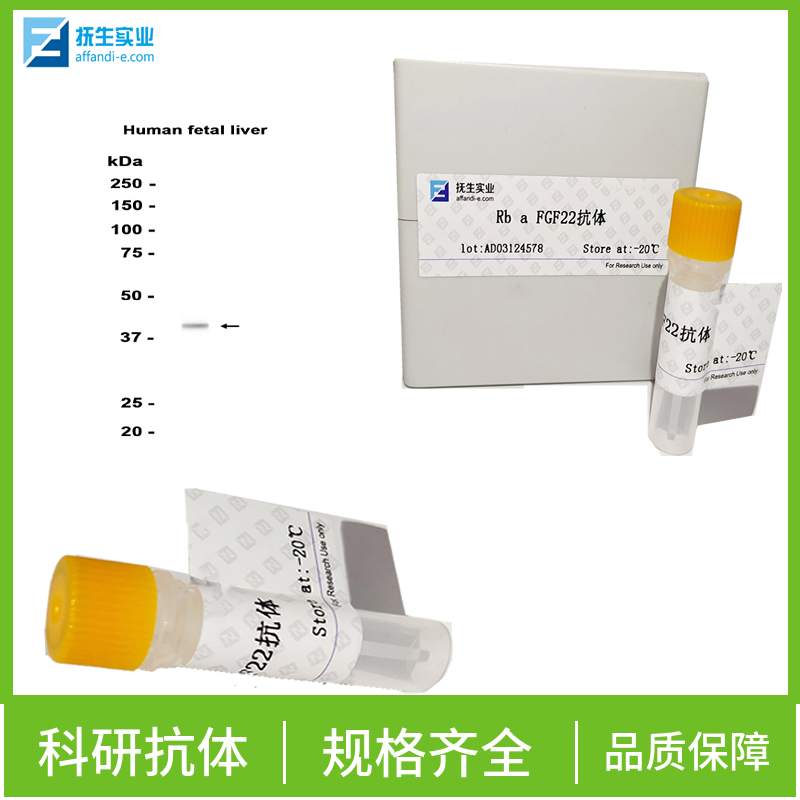 HERC6 E3泛素蛋白连接酶抗体