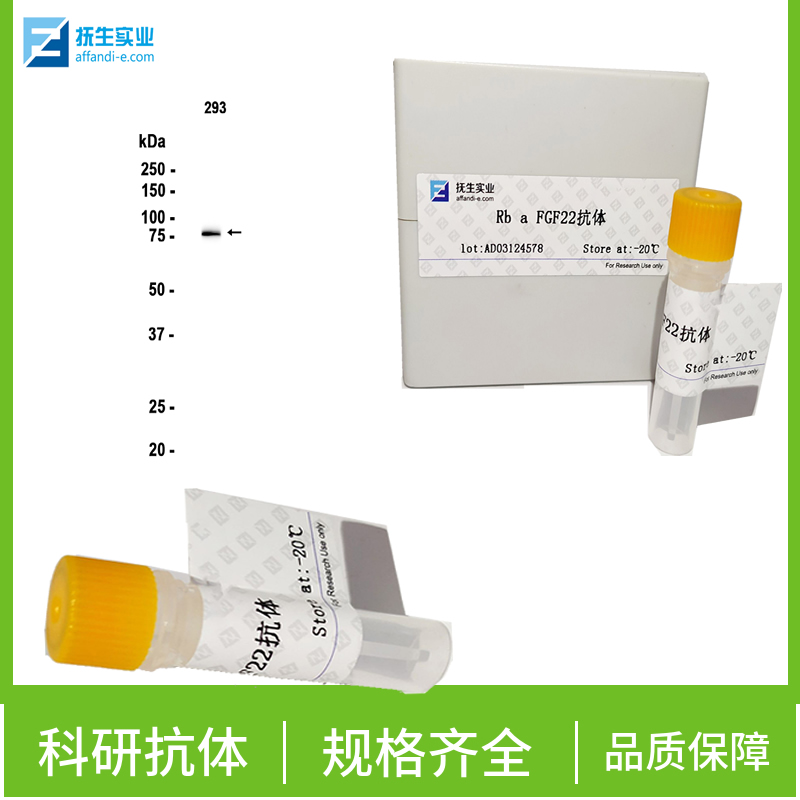 磷酸化蛋白激酶AKT1,2,3抗体