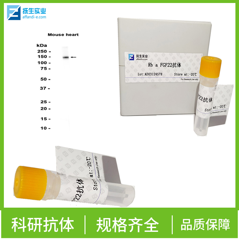 磷酸化蛋白酪氨酸激酶JAK-3抗体