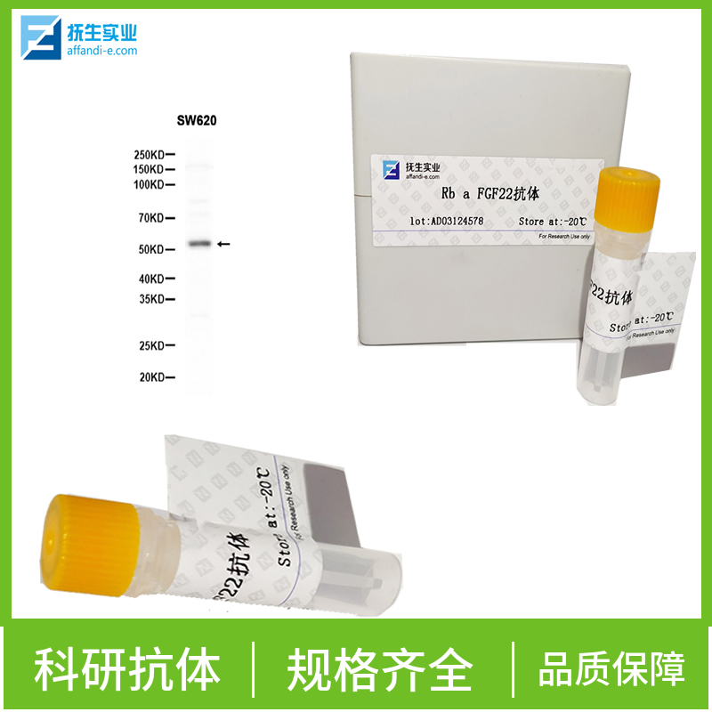 磷酸化活化T细胞核因子1蛋白抗体