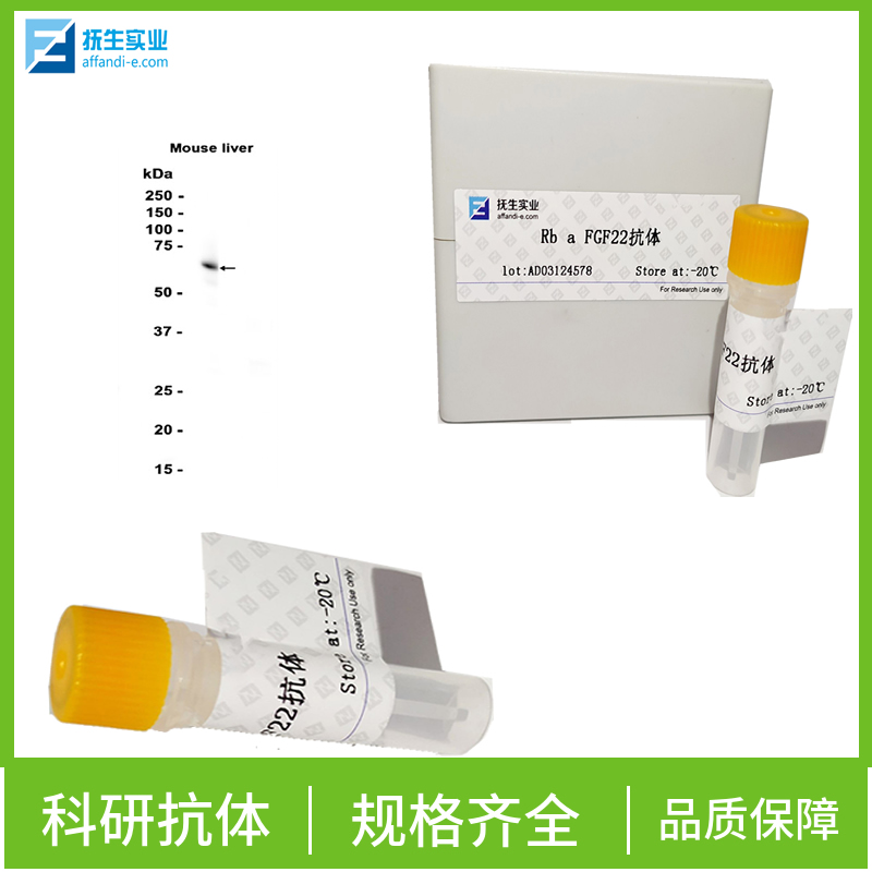 酪氨酸酶相关蛋白1抗体