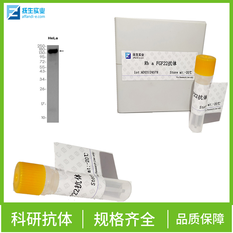 淋巴细胞趋化因子CCL21/Exodus 2抗体