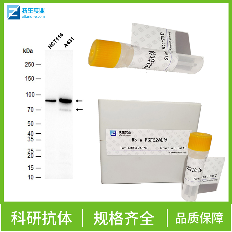 活化诱导分子CD69抗体