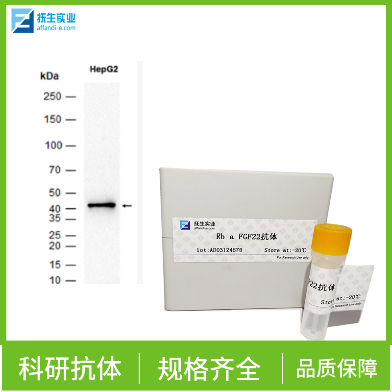 鸡传染性法氏囊病病毒VP2蛋白抗体