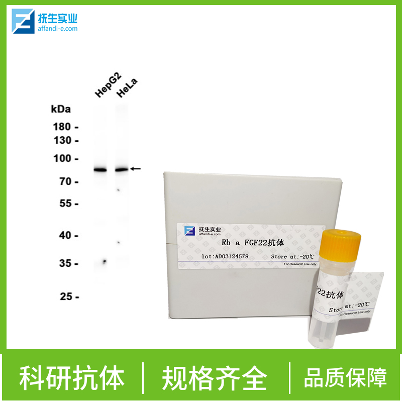基质金属蛋白酶13抗体
