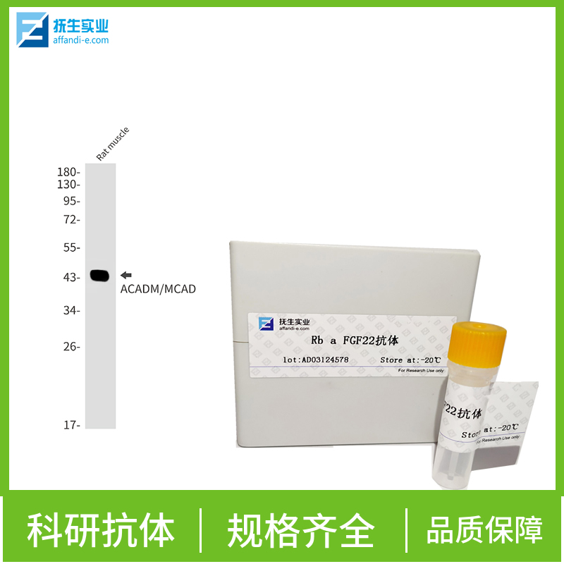 瓜氨酸环肽抗体