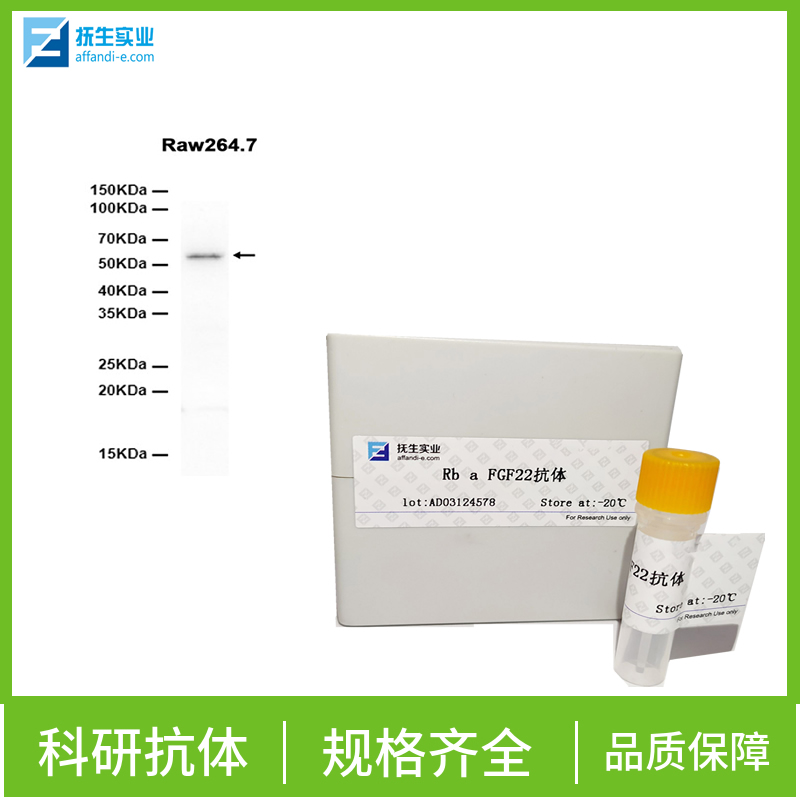 冠状病毒表面S蛋白抗体