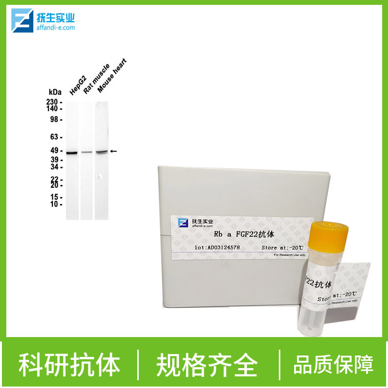 核糖核蛋白自身抗原抗体