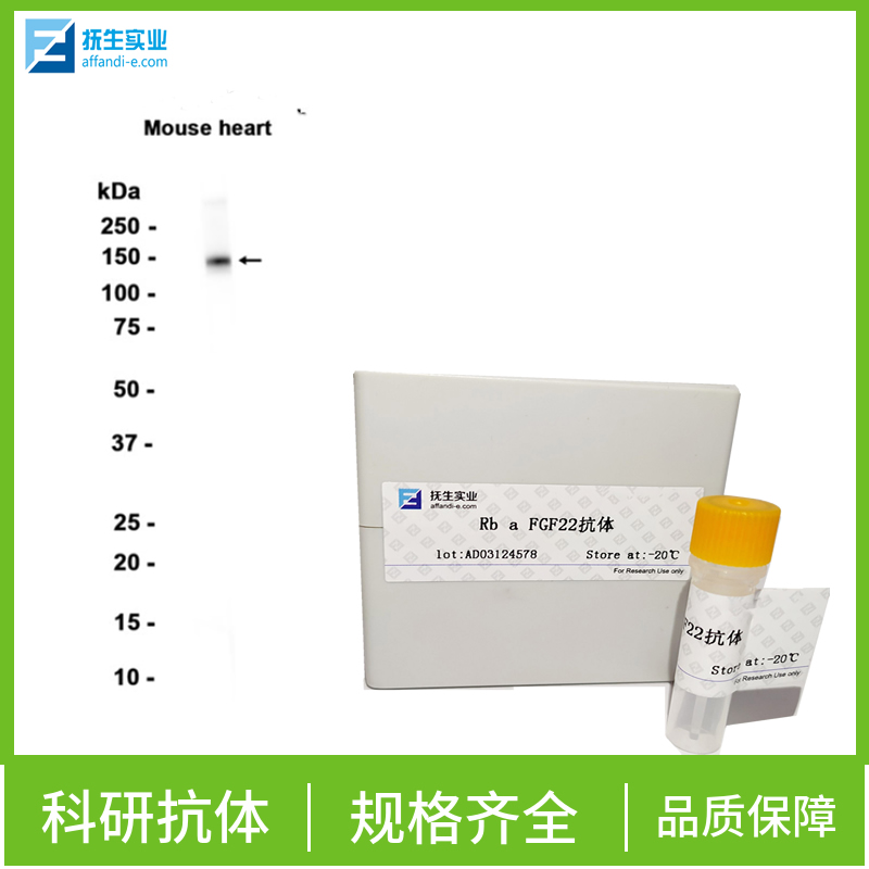 巢蛋白/神经上皮干细胞蛋白抗体