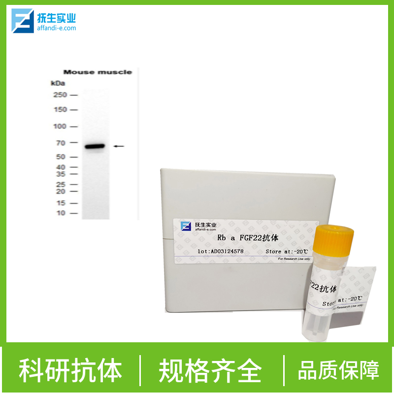 成纤维细胞生长因子受体2抗体