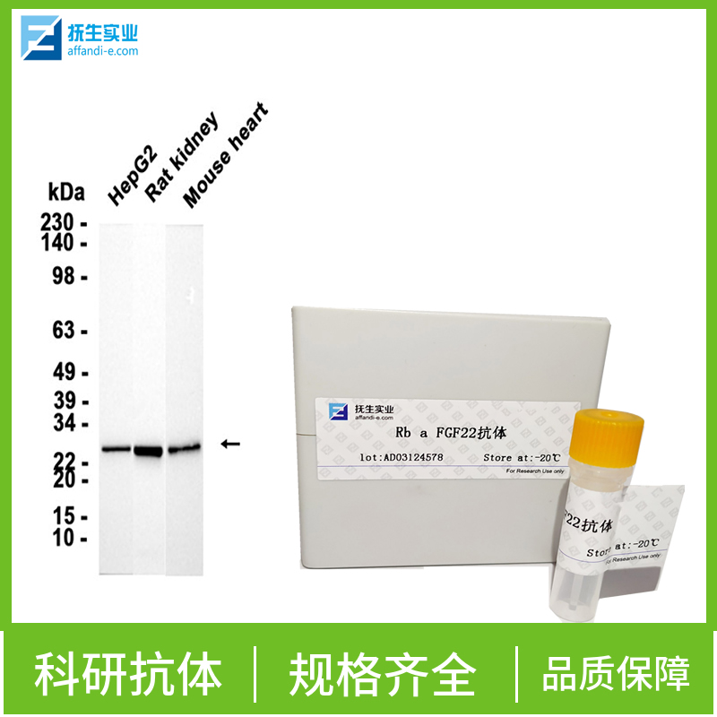 催产素受体(缩宫素受体)抗体