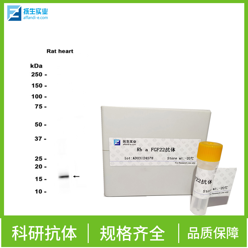 叉头蛋白J1抗体