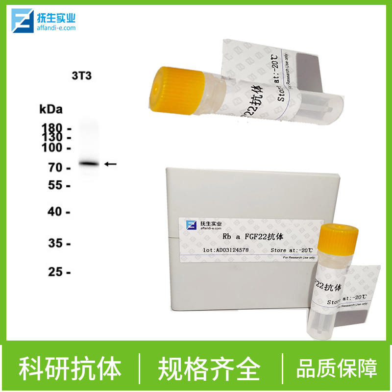 成骨细胞特异性因子2抗体