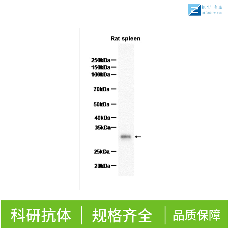 可溶性载质转运蛋白22A17抗体