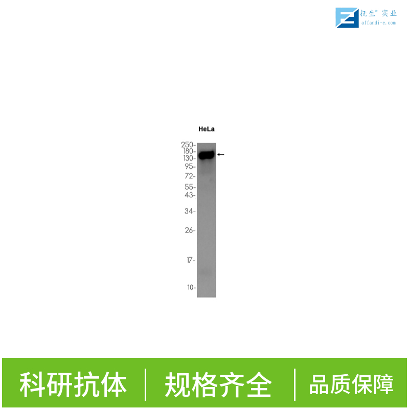 可溶性载质转运蛋白2B1抗体