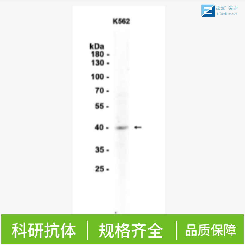 口蹄疫病毒3D聚合酶抗体