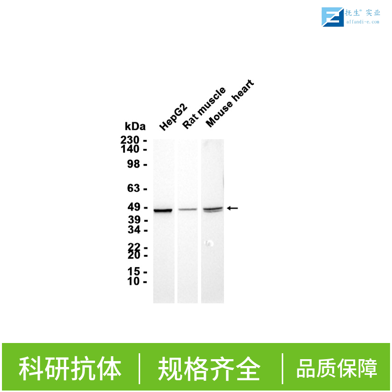 扩张型心肌病蛋白1G抗体