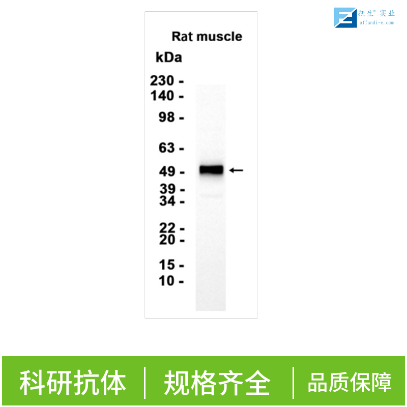 淋巴细胞抗原6G抗体