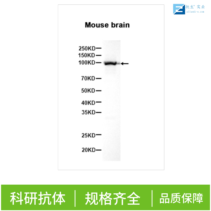 磷酸化IRE1蛋白抗体