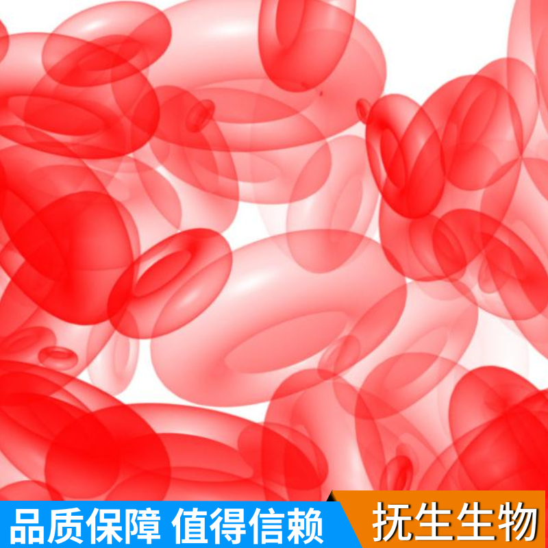 人急性T淋巴细胞白血病细胞带荧光素酶；Jurkat/LUC (STR)