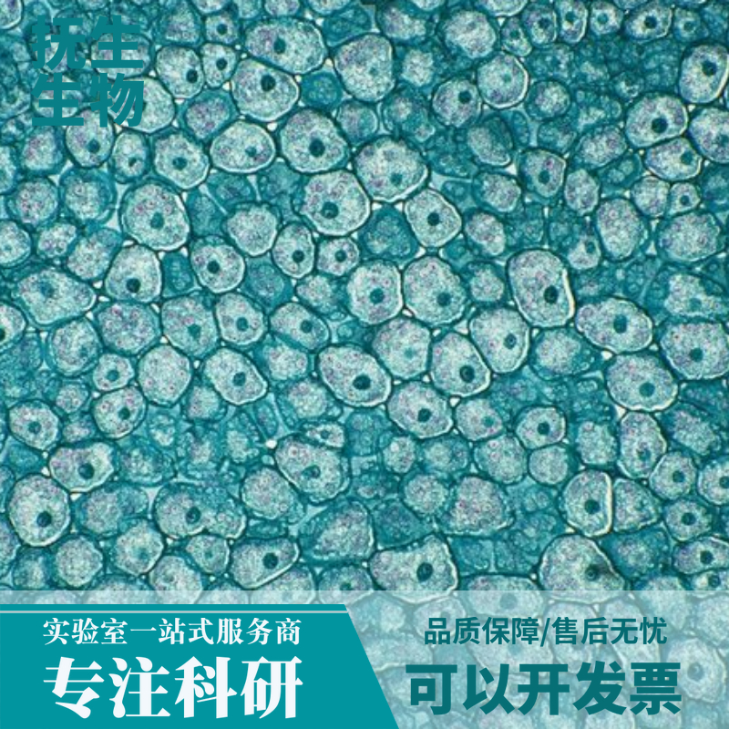 人卵巢癌细胞；Anglne