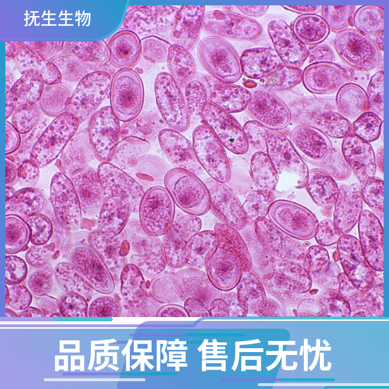 人B细胞淋巴瘤；U2932