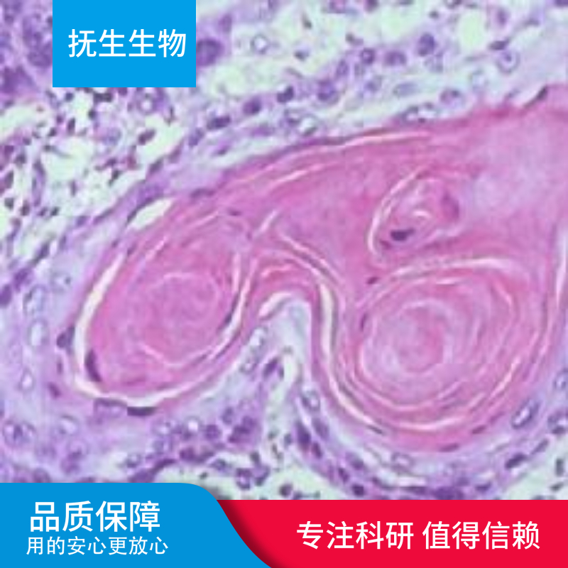 人乳腺癌细胞；BT549+GFP+LUC