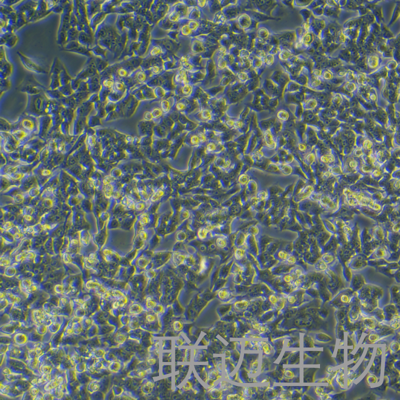 RM-1细胞（小鼠前列腺癌细胞）LM8C0198