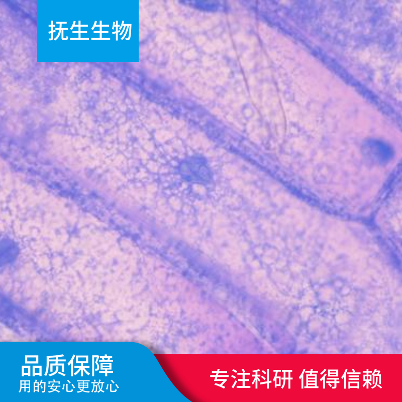 GAK人黑色素瘤细胞
