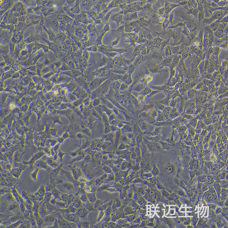 CaES-17细胞（食管癌细胞）LM8C0051