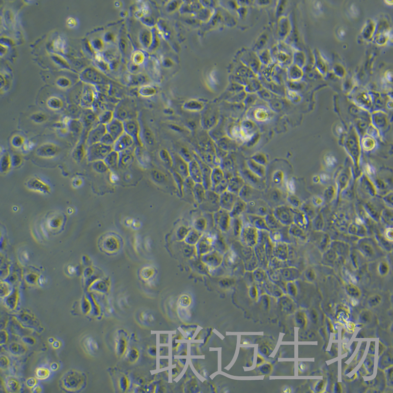 NCI-H292细胞（肺癌细胞淋巴结转移STR鉴定正确）LM8C0167